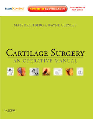 Cartilage Surgery, London, Saunders (W.B.) Co Ltd, 2010