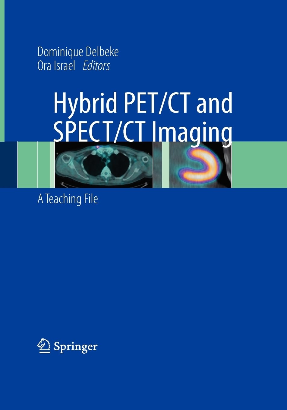Hybrid PET/CT and SPECT/CT Imaging, Heidelberg, Springer Verlag GmbH, 2009