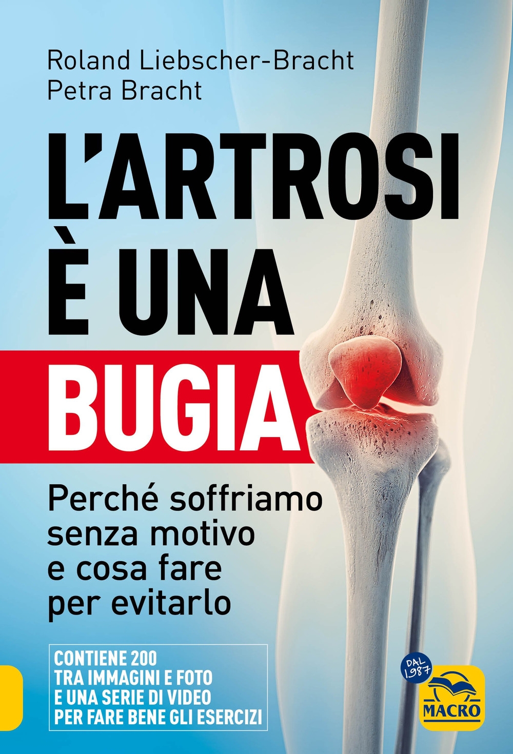 L'artrosi è una bugia. Perché soffriamo senza motivo e cosa …