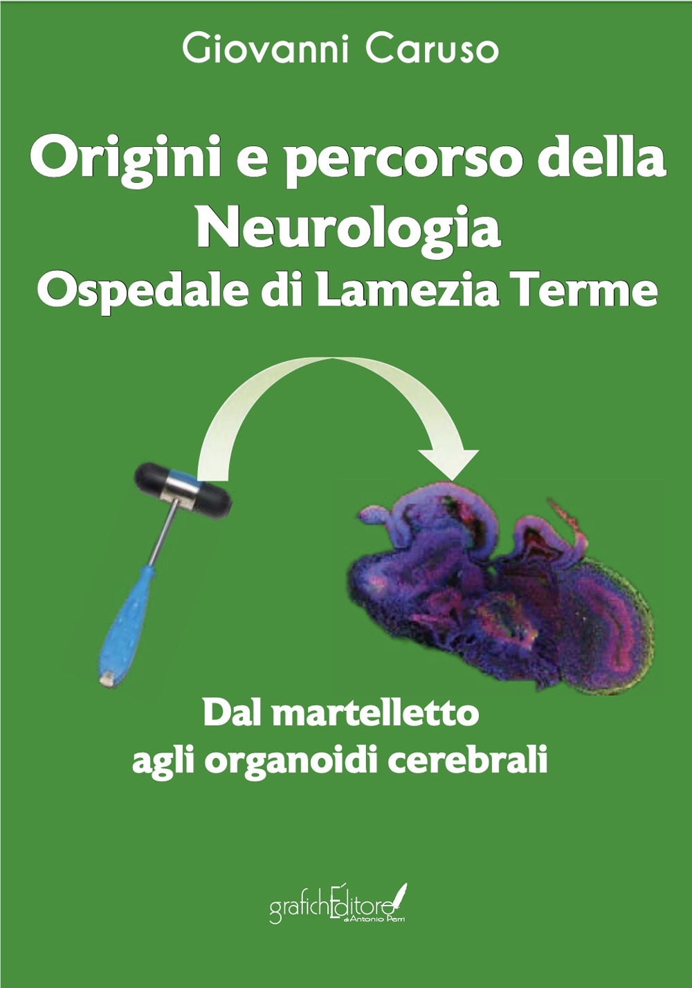 Origini e percorso della neurologia. Ospedale di Lamezia Terme. Dal …