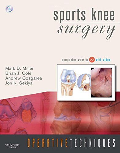 Sports Knee Surgery, London, Saunders (W.B.) Co Ltd, 2008