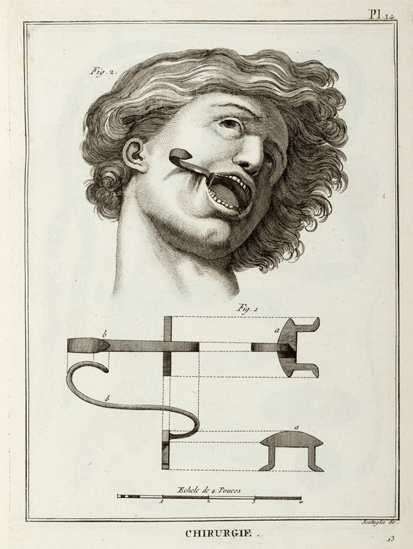 Encyclopédie Méthodique. ou par ordre de matiéres. Chirurgie