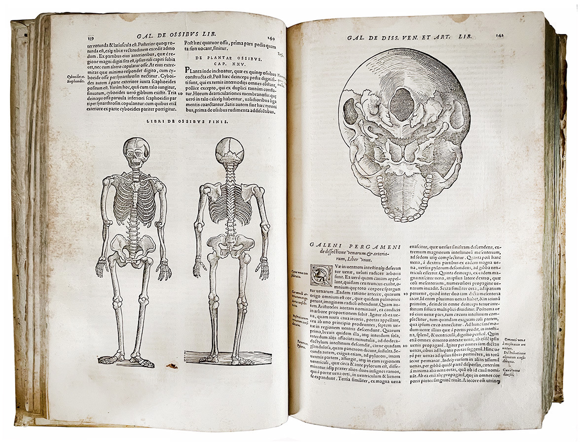 Epitome Galeni Pergameni operum, in quatuor partes digesta, pulcherrima methodo …