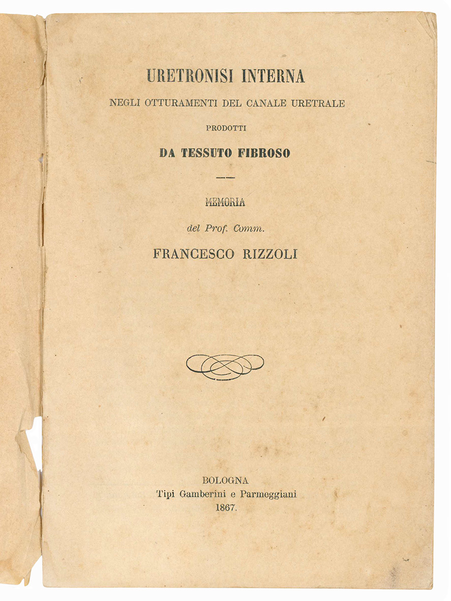 Uretronisi interna negli otturamenti del canale uretrale prodotti da tessuto …