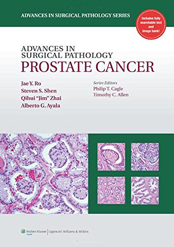 Advances in Surical Pathology Prostate Cancer
