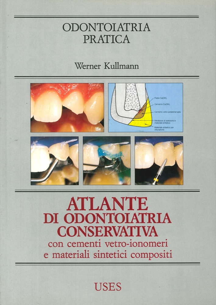 Atlante di Odontoiatria Conservativa con Cementi Vetro-Ionomeri e Materiali Sintetici …