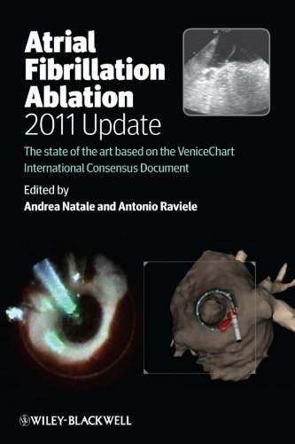 Atrial Fibrillation Ablation 2011 Update: the State of the Art …