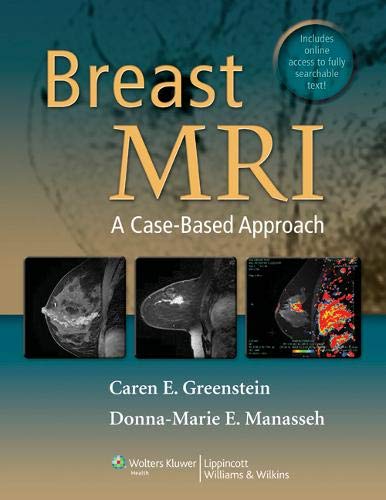 Breast Mri: a Case-Based Approach