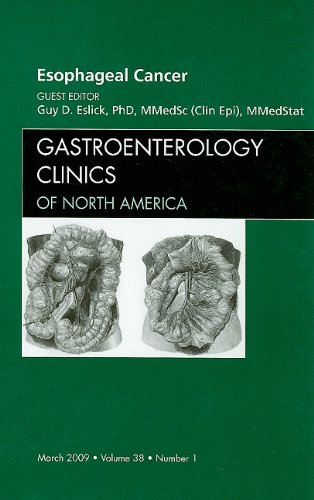 Esophageal Cancer, An Issue of Gastroenterology Clinics, 1e