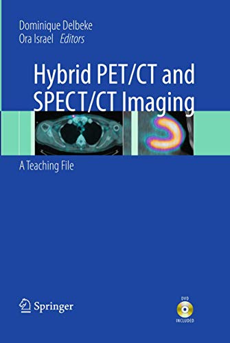 Hybrid Pet/Ct and Spect/Ct Imaging: a Teaching File