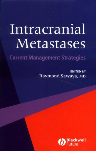 Intracranial Metastases: Current Management Strategies