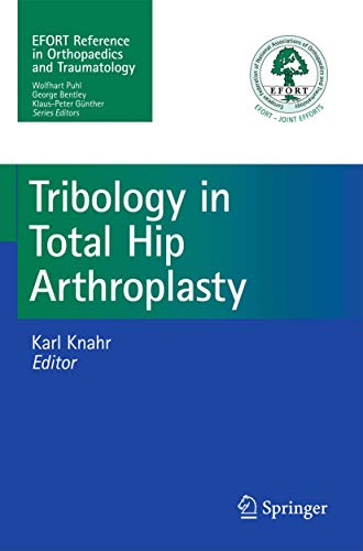 Triboilogy in Totral Hip Arthroplasty