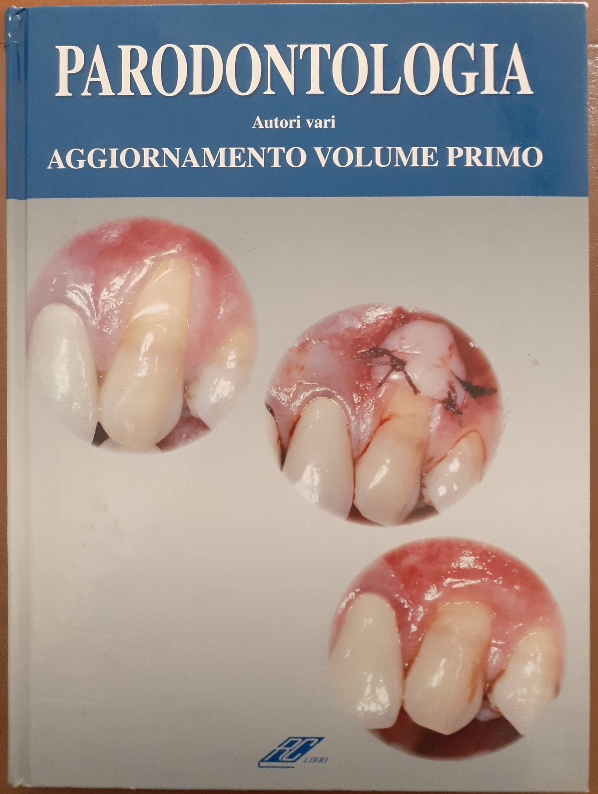 Abbinante et al., Parodontologia. Aggiornamento. Volume primo