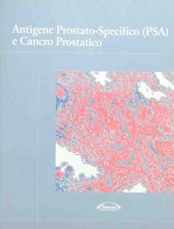Antigene prostatico-specifico (PSA) e cancro prostatico