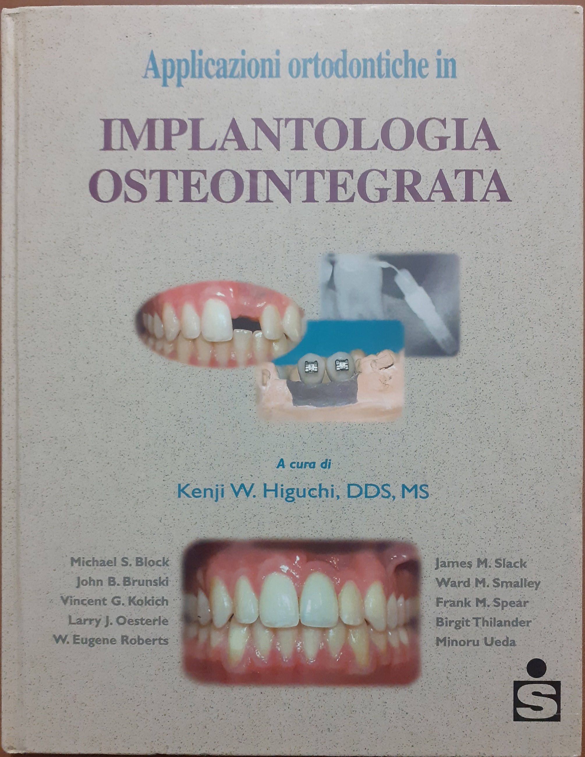 Applicazioni ortodontiche in implantologia osteointegrata, a cura di K. W. …