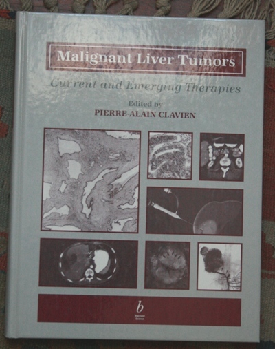 malignant liver tumors - current and emerging therapies