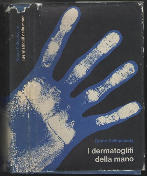 I dermatoglifi della mano.