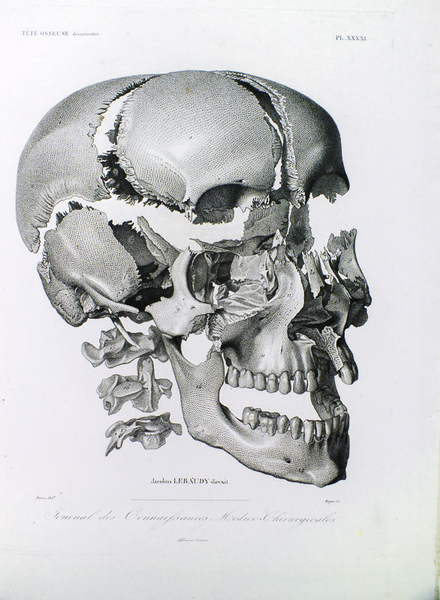 Atlas du Journal des Connaissances médico-chirurgicales