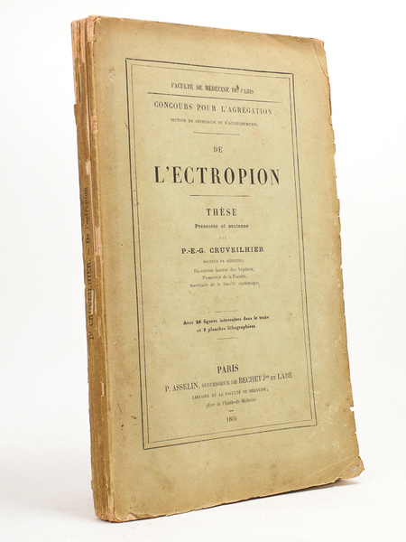 De l'ectropion , Thèse présenté et soutenue par P.-E.-G. Cruveilhier. …