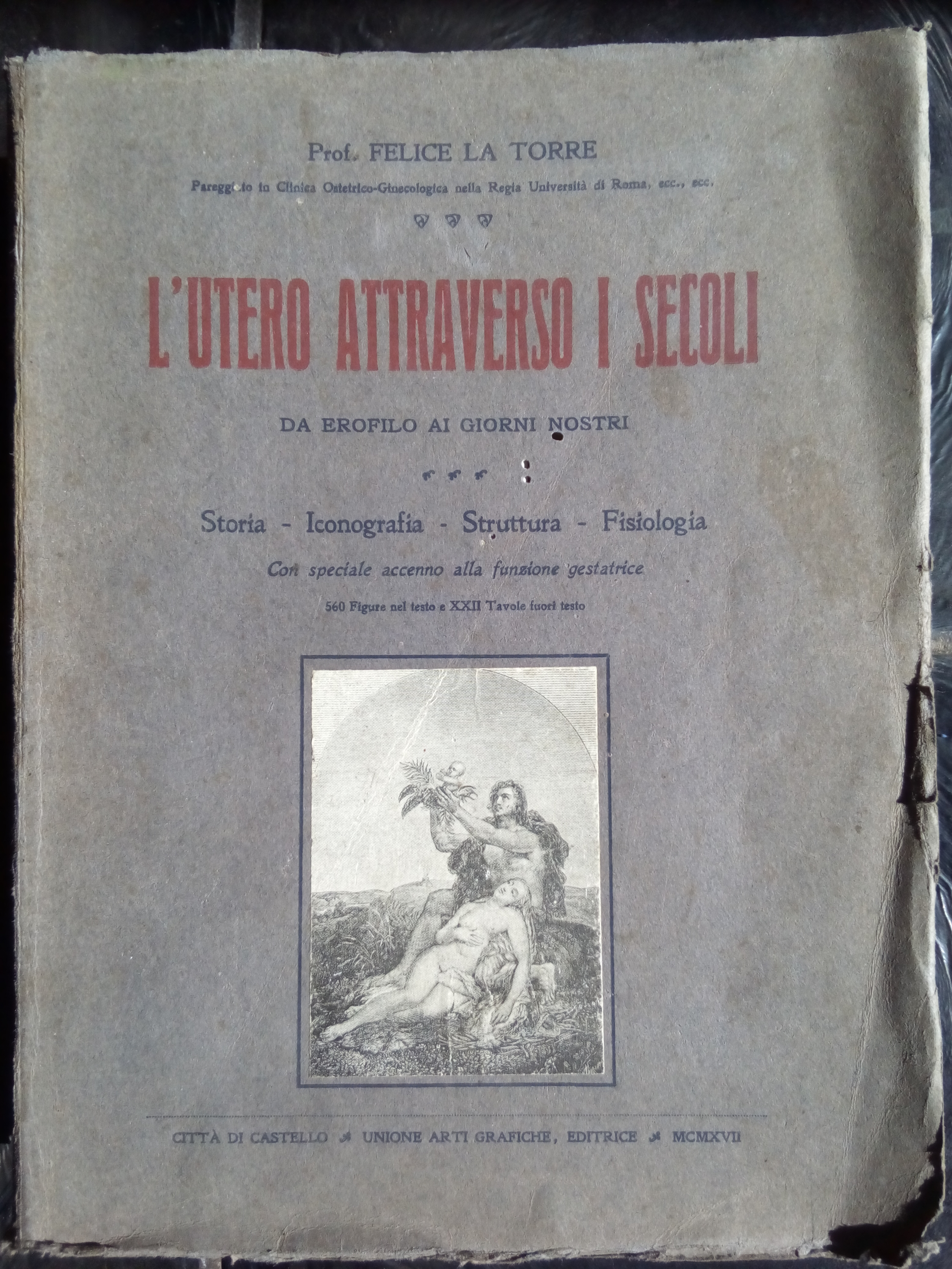 L'utero attraverso i secoli 1917