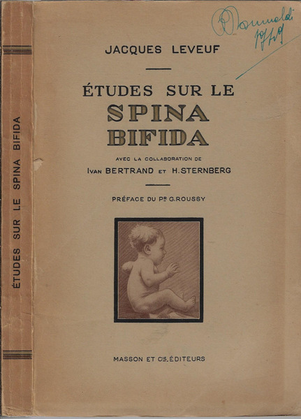Etudes sur le Spina Bifida