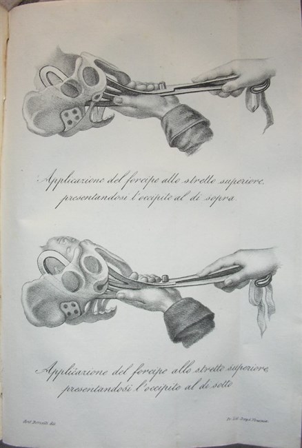 CORSO TEORICO E PRATICO di Ostetricia nel quale si espongono …