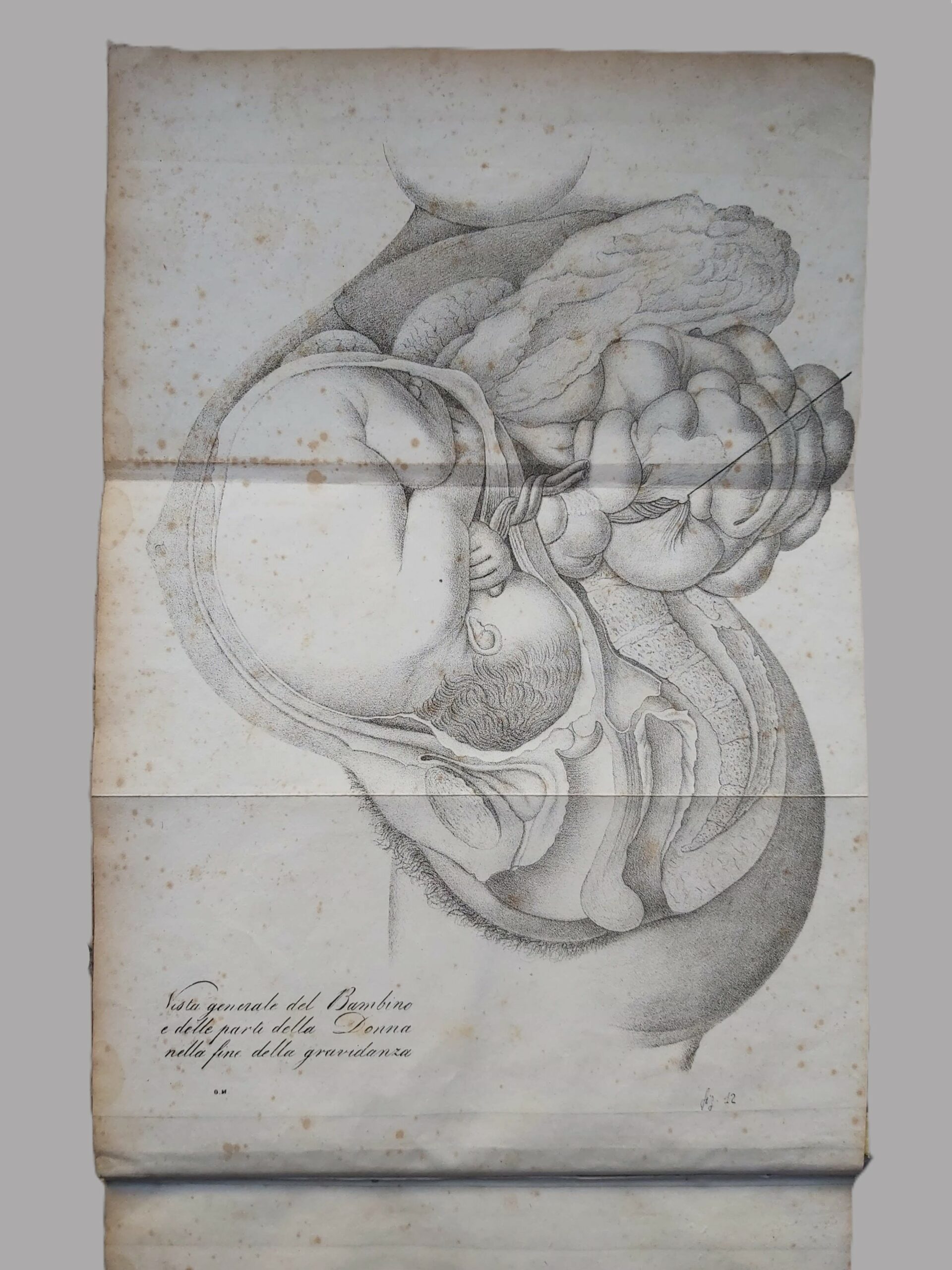 CORSO TEORICO-PRATICO di Ostetricia di. Traduzione Italiana di Giuseppe Coen …