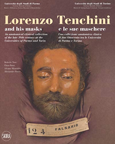 Lorenzo Tenchini e le sue maschere. Una collezione anatomica clinica …