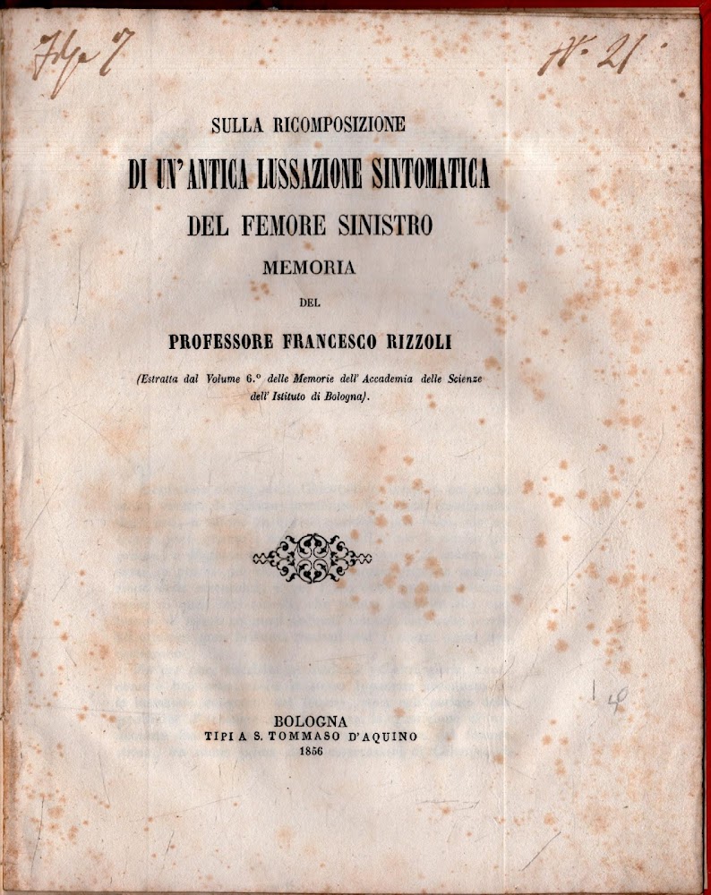 Sulla Ricomposizione di un'antica lussazione sintomatica del femore sinistro. Memoria …