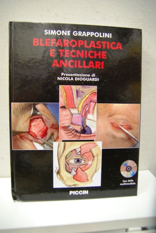 Blefaroplastica e tecniche ancillari