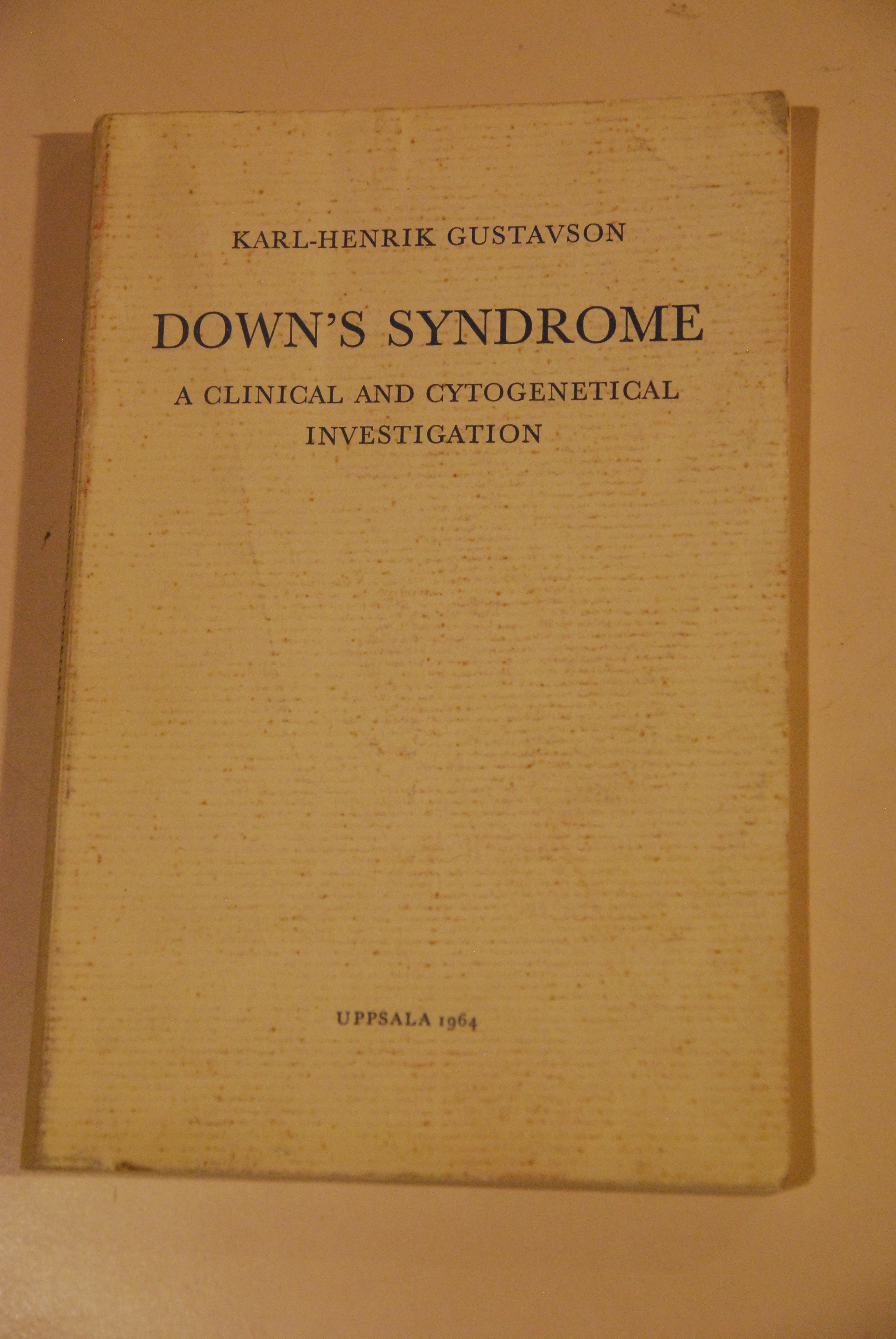 down's syndrome NUOVO