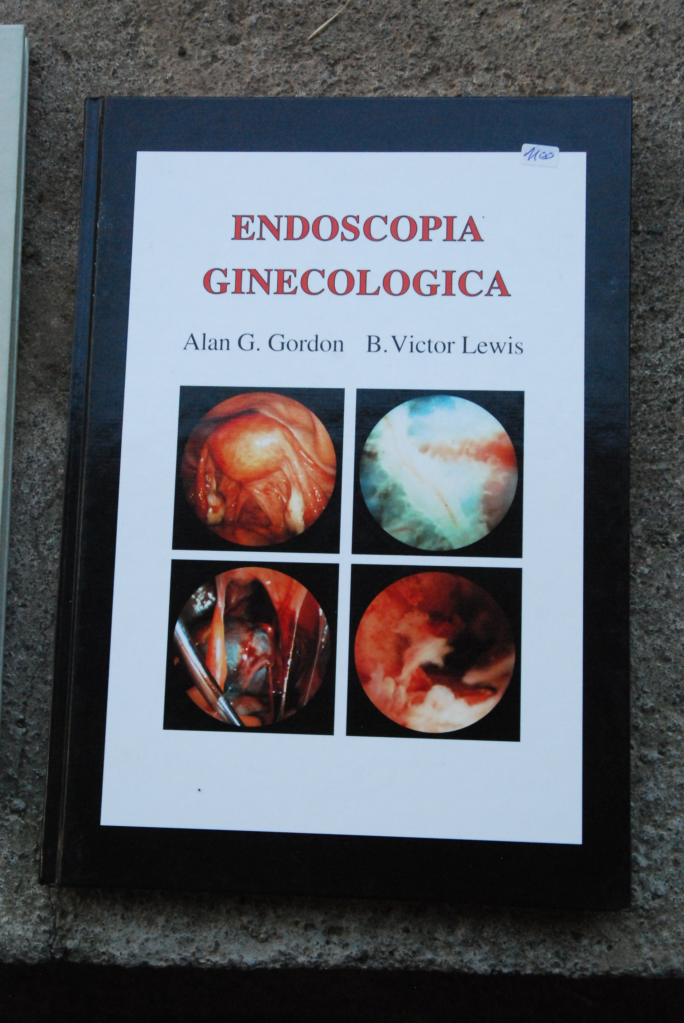 endoscopia ginecologica NUOVO