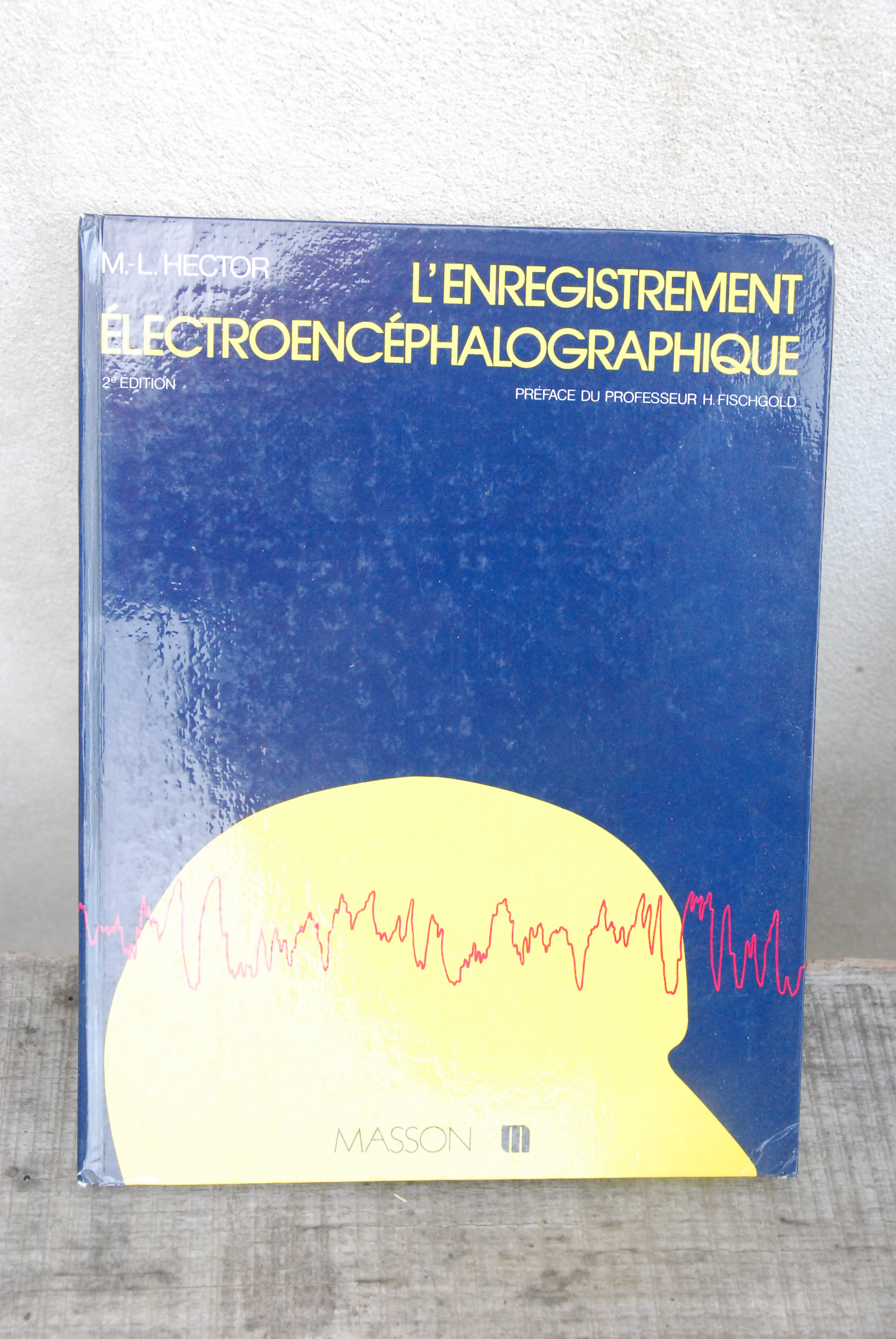 l'enregistrement electroencephalographique NUOVO