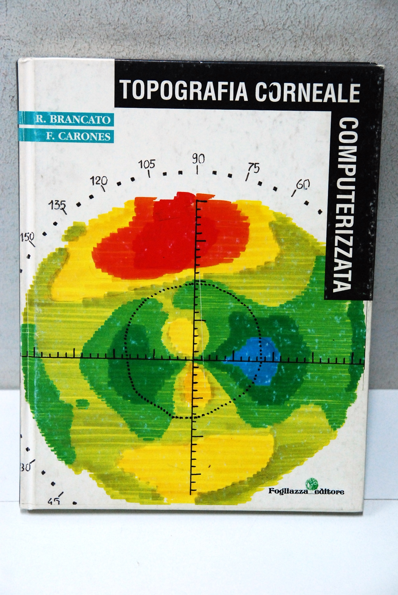 topografia corneale computerizzata NUOVO