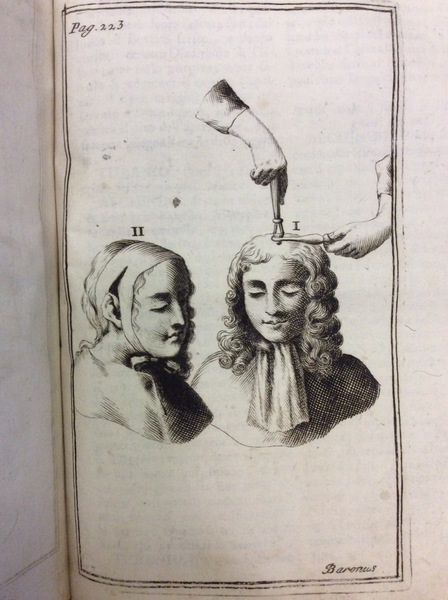 OPERE CHIRURGICHE. - Divise in tre parti. Corrette dal medesimo …