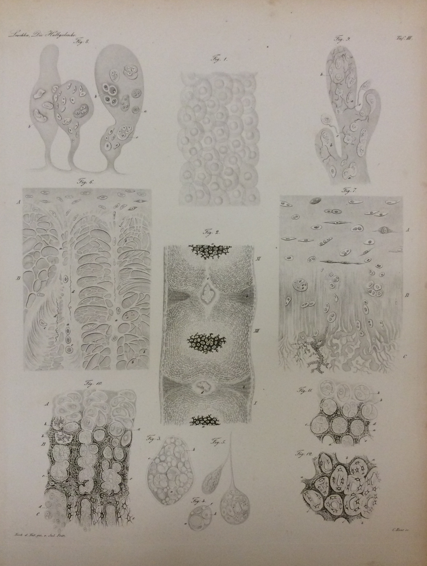 DIE HALBGELENKE DES MENSCHLICHEN KORPERS. - Eine Monographie mit sechs …