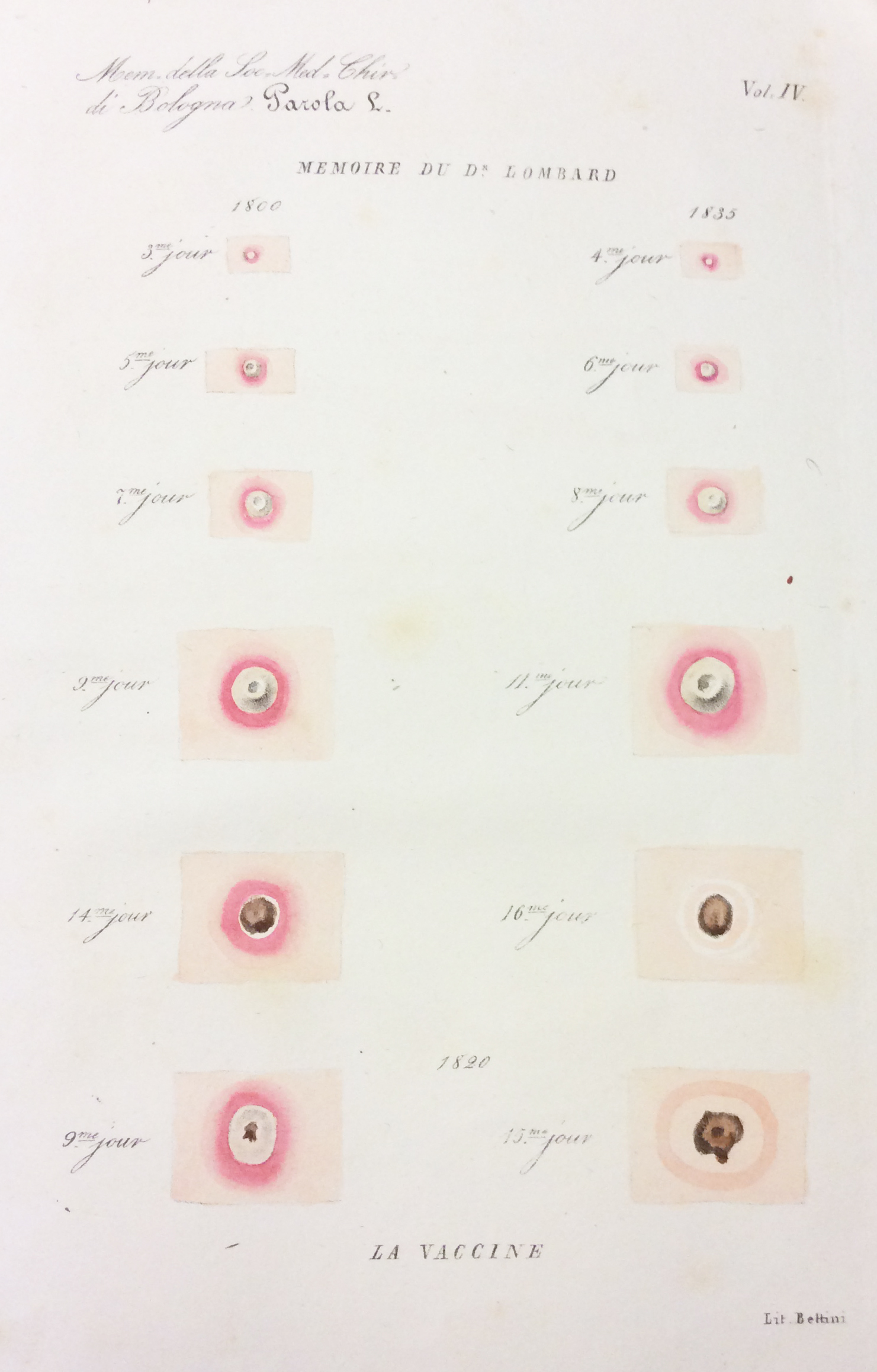 DISCORSO SULLA DOTTRINA VACCINICA IN RISPOSTA AL PROGRAMMA DELLA SOCIETA' …