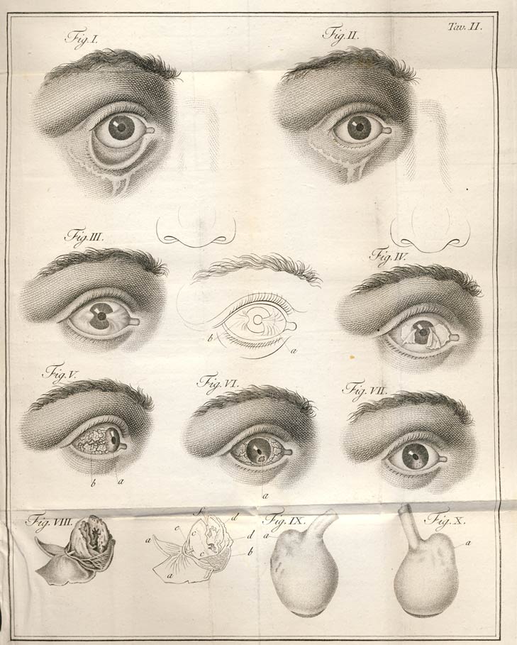 SAGGIO DI OSSERVAZIONI E D'ESPERIENZE SULLE PRINCIPALI MALATTIE DEGLI OCCHI.