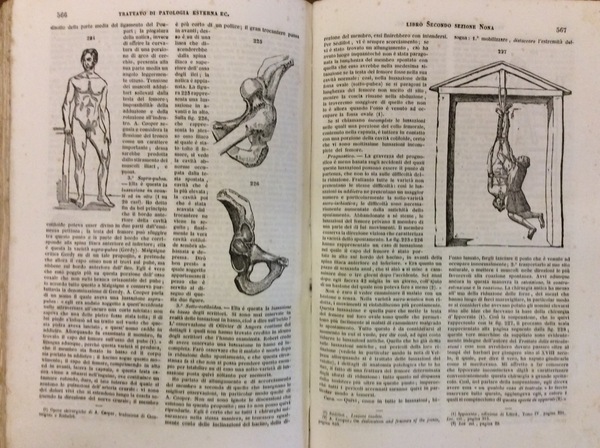 TRATTATO DI PATOLOGIA ESTERNA E DI MEDICINA OPERATORIA. - Traduzione …