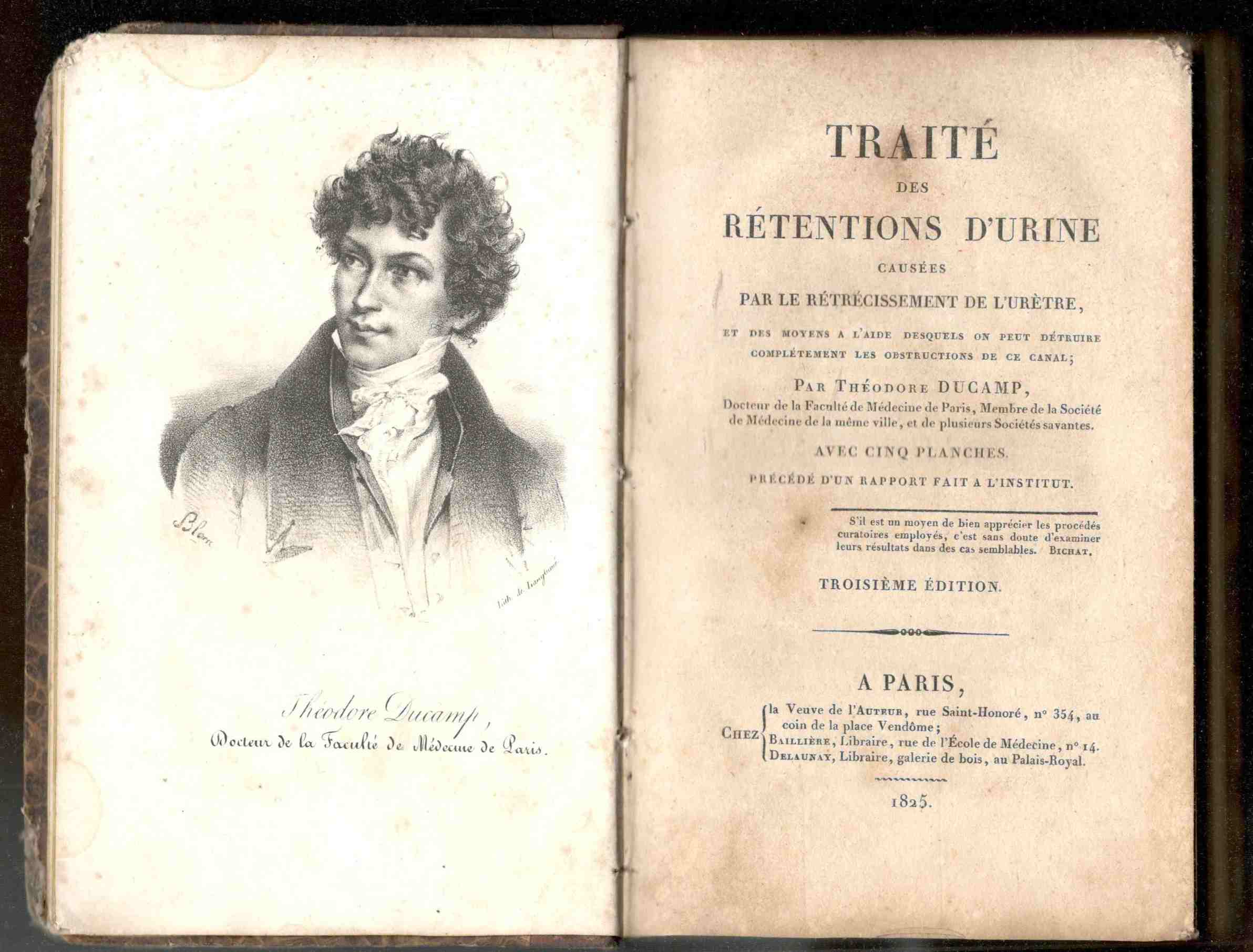 Traité des rétentions d'urine causées par le rétrécissement de l'urètre, …