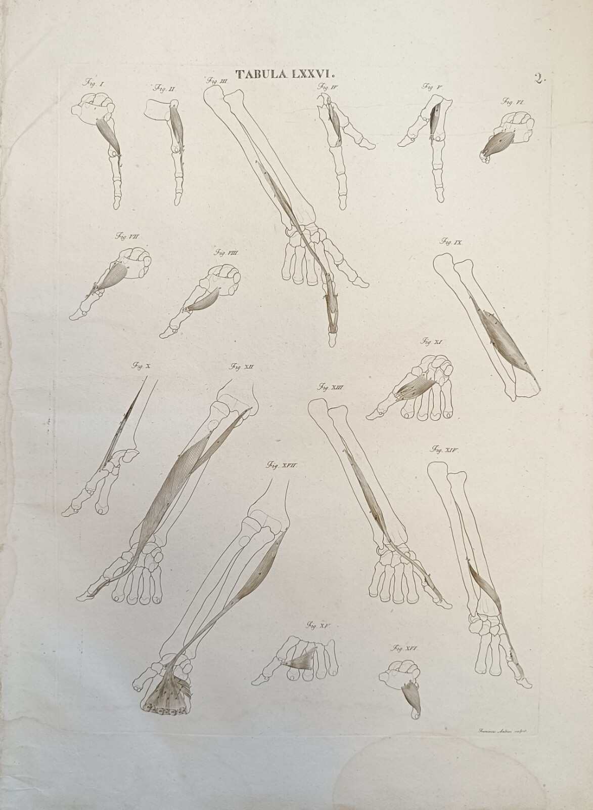 TABULA ANATOMICA LXXVI