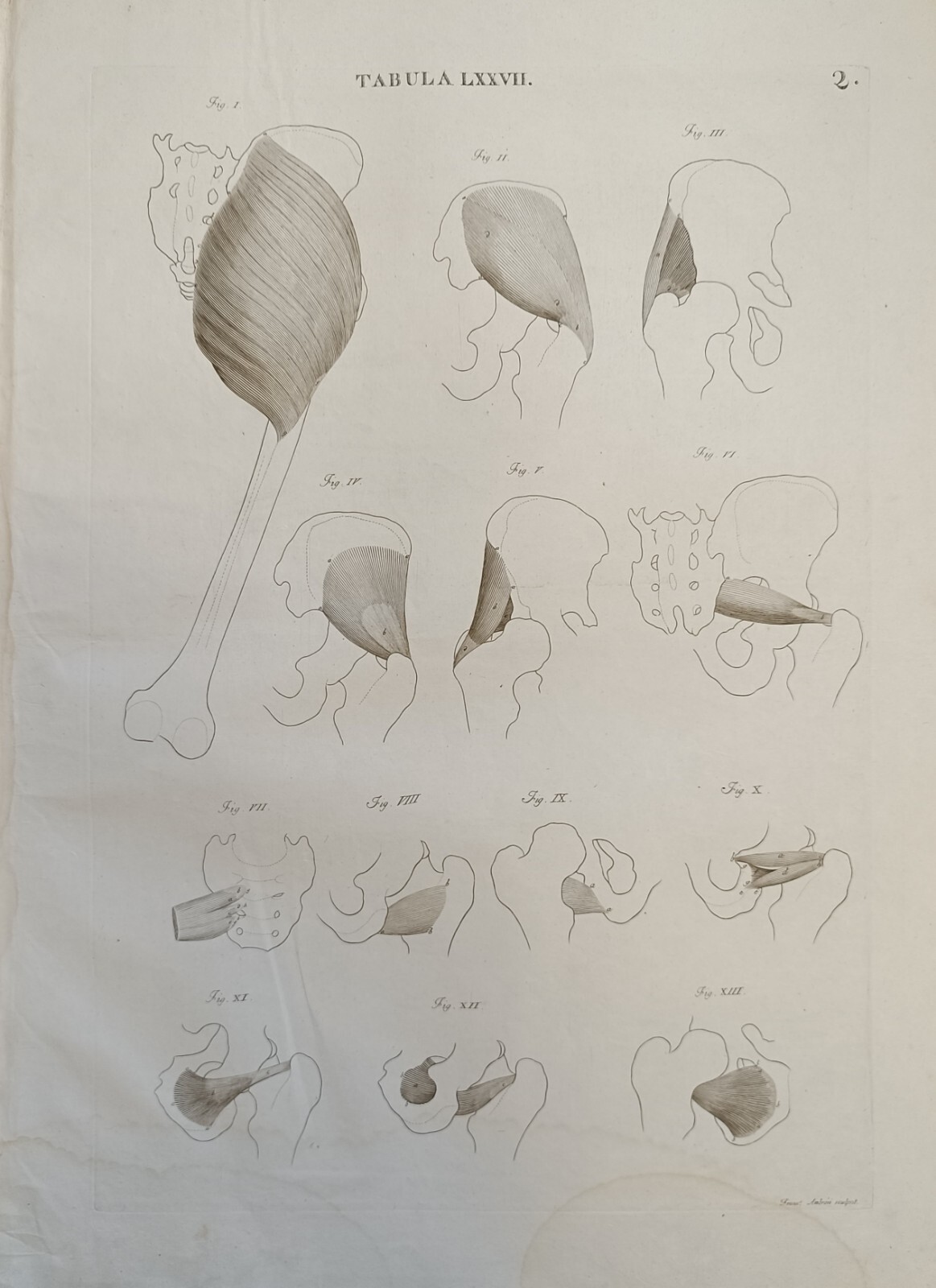 TABULA ANATOMICA LXXVII