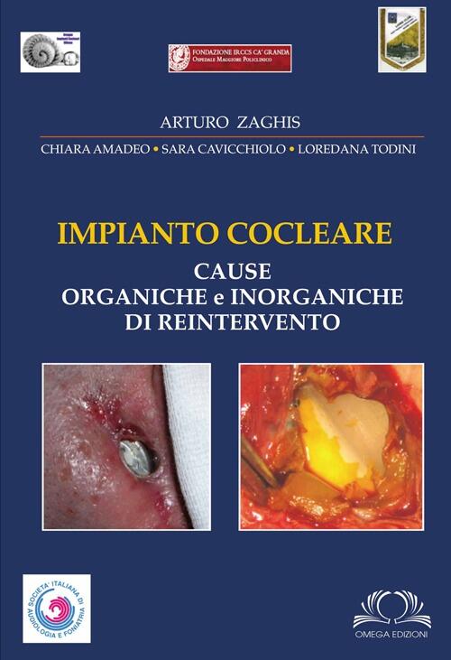 Impianto Cocleare. Cause Organiche E Inorganiche Di Reintervento