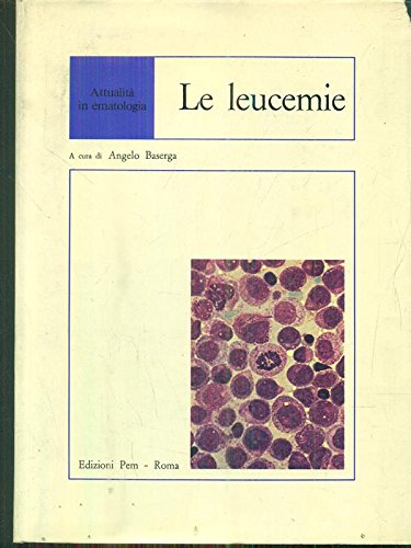 Le leucemie