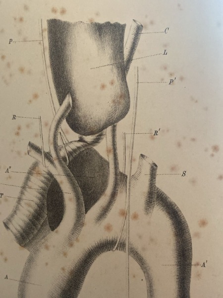 saggi di clinica speciale chirurgica otoiatria laringoiatria rinoiatria 1887 due …