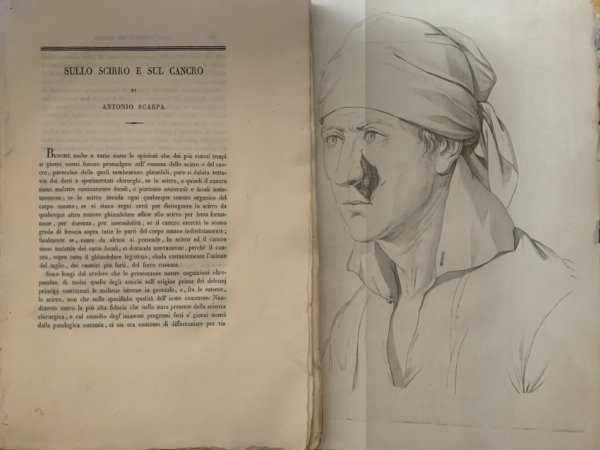SULLO SCIRRO E SUL CANCRO ANTONIO SCARPA
