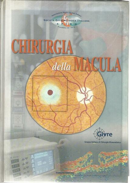 Chirurgia della macula