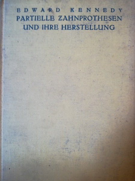 Partielle Zahnprothesen und ihre Herstellung