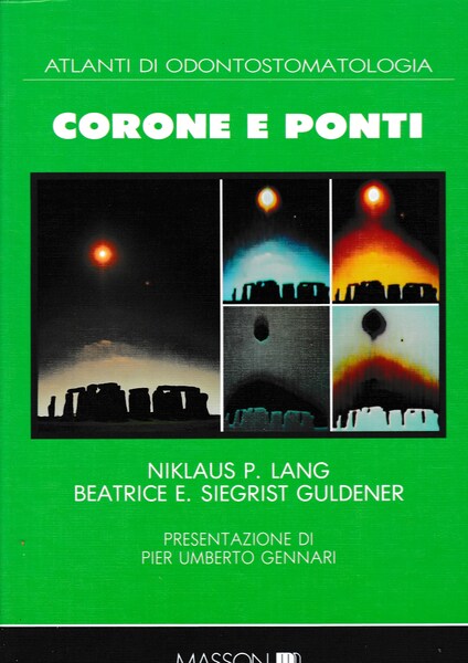 Atlanti di Odontostomatologia. Corone e Ponti