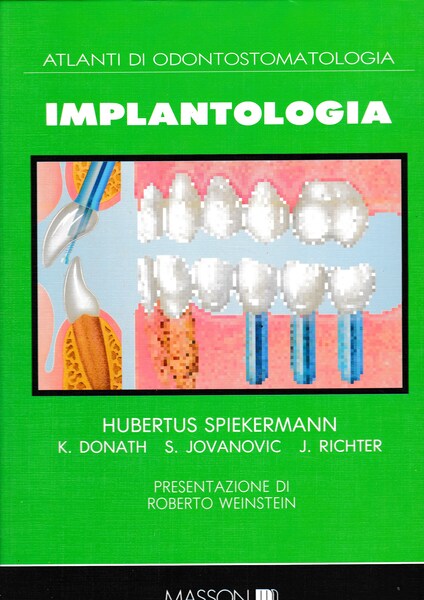 Atlanti di Odontostomatologia. Implantologia